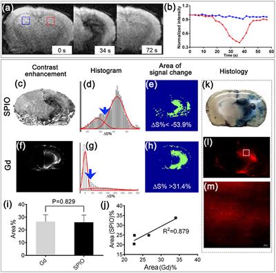 Real-Time MRI Guidance for Reproducible Hyperosmolar Opening of the Blood-Brain Barrier in Mice